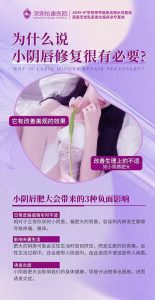 香港陰唇修復手術收費＋過程｜專科醫生拆解