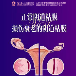 【私密健康】黏膜受損點解會咁影響生活?深圳女性點樣修復重建水潤屏障